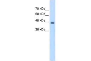 Western Blotting (WB) image for anti-Phosphate Cytidylyltransferase 2, Ethanolamine (PCYT2) antibody (ABIN2462716) (PCYT2 Antikörper)