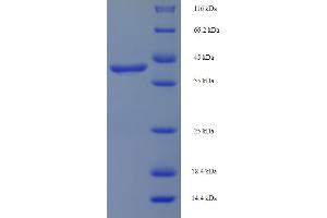 SDS-PAGE (SDS) image for DAG Kinase gamma (AA 1-255), (partial) protein (His-SUMO Tag) (ABIN5709399)