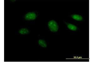 Immunofluorescence of purified MaxPab antibody to ARL3 on HeLa cell. (ARL3 Antikörper  (AA 1-182))