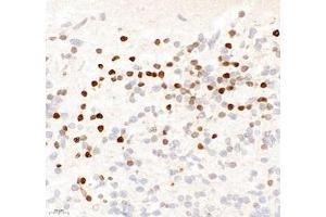Immunohistochemistry of paraffin embedded rat embryonic rat using OTX2 (ABIN7074952) at dilution of 1:600 (400x lens) (OTX2 Antikörper)
