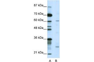 WB Suggested Anti-NR1I2 Antibody Titration:  5. (NR1I2 Antikörper  (C-Term))
