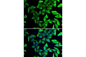 Immunofluorescence analysis of U2OS cells using VSNL1/VILIP-1 antibody (ABIN3016717, ABIN3016718, ABIN3016719 and ABIN6219826). (VSNL1 Antikörper  (AA 1-191))