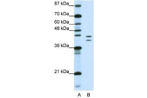 WB Suggested Anti-HNRPD  Antibody Titration: 1. (HNRNPD/AUF1 Antikörper  (N-Term))