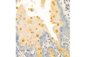 Immunohistochemistry of paraffin embedded mouse duodenum using CLCA1 (ABIN7073472) at dilution of 1:700 (400x lens)