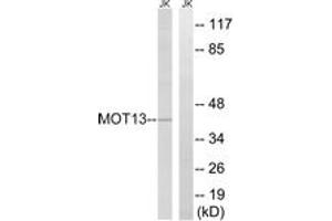 Western blot analysis of extracts from Jurkat cells, using MOT13 Antibody. (SLC16A13 Antikörper  (AA 377-426))