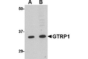 Western Blotting (WB) image for anti-Growth Hormone Regulated TBC Protein 1 (GRTP1) (N-Term) antibody (ABIN1031398) (GRTP1 Antikörper  (N-Term))