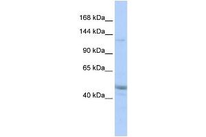 WB Suggested Anti-KIAA0319L Antibody Titration:  0. (KIAA0319L Antikörper  (Middle Region))