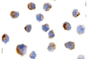Immunohistochemistry (IHC) image for anti-Peptidyl-tRNA Hydrolase 2 (PTRH2) (N-Term) antibody (ABIN1031275) (PTRH2 Antikörper  (N-Term))