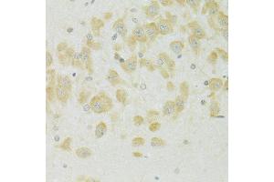 Immunohistochemistry of paraffin-embedded rat brain using SLC37A4 antibody (ABIN6292412) at dilution of 1:100 (40x lens). (SLC37A4 Antikörper)