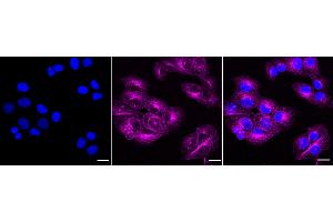 Immunocytochemical staining of HT- cells with MAGEA1 antibody (ABIN7799356), 1:1,000).