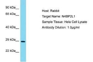 Host: Rabbit Target Name: N4BP2L1 Sample Type: Hela Whole Cell lysates Antibody Dilution: 1.