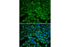 Immunofluorescence analysis of A549 cells using GSS antibody (ABIN6290429). (Glutathione Synthetase Antikörper)