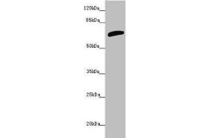 Western blot All lanes: SLC6A12 antibody at 4. (SLC6A12 Antikörper  (AA 515-614))