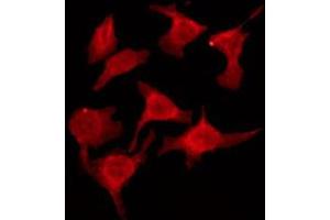 ABIN6274572 staining HeLa by IF/ICC. (Serotonin Receptor 2B Antikörper  (Internal Region))