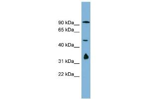 WB Suggested Anti-MAK10 Antibody Titration:  0. (MAK10/NAA35 Antikörper  (N-Term))