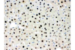IHC analysis of RbAp48 using anti-RbAp48 antibody (ABIN3043920). (Retinoblastoma Binding Protein 4 Antikörper  (C-Term))