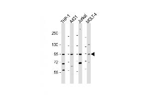 All lanes : Anti-IL12RB2 Antibody (C-term) at 1:2000 dilution Lane 1: THP-1 whole cell lysate Lane 2: A431 whole cell lysate Lane 3: Jurkat whole cell lysate Lane 4: MOLT-4 whole cell lysate Lysates/proteins at 20 μg per lane. (IL12_2 (AA 756-783), (C-Term) Antikörper)