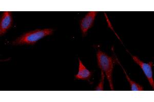 Immunofluorescence (IF) image for anti-Connective Tissue Growth Factor (CTGF) (AA 27-349) antibody (APC) (ABIN5565322) (CTGF Antikörper  (AA 27-349) (APC))