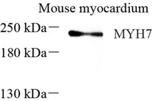 Western blot analysis of MYH7 (ABIN7075623),at dilution of 1: 600 (Slow Skeletal Myosin Heavy Chain Antikörper)