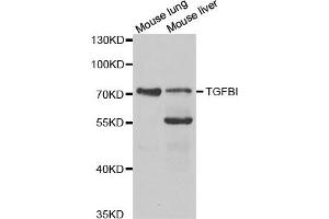 Western Blotting (WB) image for anti-Transforming Growth Factor, beta-Induced, 68kDa (TGFBI) antibody (ABIN1875076) (TGFBI Antikörper)