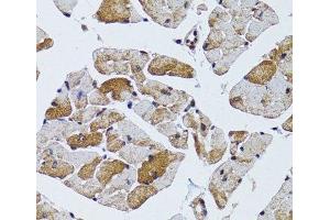 Immunohistochemistry of paraffin-embedded Mouse heart using MRPS6 Polyclonal Antibody at dilution of 1:100 (40x lens). (MRPS6 Antikörper)