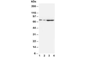 Western blot testing of PCSK9 antibody and Lane 1:  A549 (PCSK9 Antikörper  (AA 671-687))