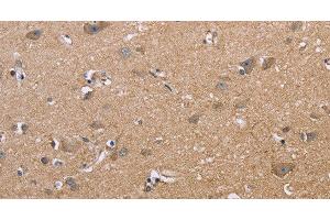 Immunohistochemistry of paraffin-embedded Human brain using MAPRE3 Polyclonal Antibody at dilution of 1:50 (MAPRE3 Antikörper)