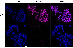 Immunocytochemical staining of Hela cells using ARID1A antibody (ABIN7797666), 1:1,000), Top panel: wild-type (WT), Bottom panal: ARID1A shRNA knockdown (KD). (Rekombinanter ARID1A Antikörper)