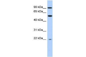 WB Suggested Anti-NR1D2 Antibody Titration:  0. (NR1D2 Antikörper  (Middle Region))
