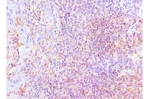 Immunohistochemistry of paraffin-embedded human tonsil tissue using ABIN7158655 at dilution of 1:100 (LSP1 Antikörper  (AA 1-339))