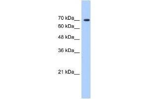 WB Suggested Anti-LAS1L Antibody   Titration: 1. (LAS1L Antikörper  (C-Term))
