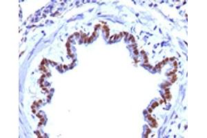 IHC testing of FFPE rat lung with FOXA1 antibody.