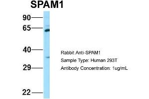 Host: Rabbit Target Name: SPAM1 Sample Type: 293T Antibody Dilution: 1.