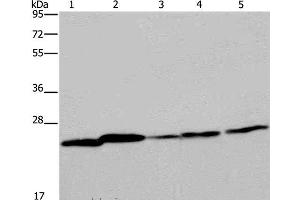 Western Blot analysis of Mouse spleen tissue, A375, A549, HT-29 and Hela cell using ARHGDIA Polyclonal Antibody at dilution of 1:350 (ARHGDIA Antikörper)