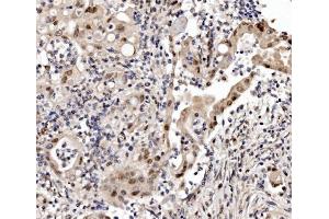 IHC analysis of Cbx8 using anti-Cbx8 antibody (ABIN7599341). (CBX8 Antikörper  (AA 1-389))