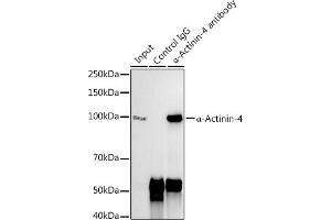 Immunoprecipitation analysis of 300 μg extracts of 293T cells using 3 μg α-Actinin-4 antibody (ABIN7265399).