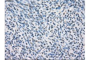 Immunohistochemical staining of paraffin-embedded colon tissue using anti-SLC2A6mouse monoclonal antibody. (SLC2A6 Antikörper)