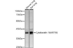 Western blot analysis of extracts of various cell lines, using Cytokeratin 19 (KRT19) antibody (ABIN3020778, ABIN3020779, ABIN3020780 and ABIN6213719) at 1:500 dilution. (Cytokeratin 19 Antikörper  (AA 241-400))
