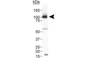 Western blot analysis of TRPA1 in human brain membrane fraction with TRPA1 polyclonal antibody at 2 ug/mL . (TRPA1 Antikörper  (AA 1-100))