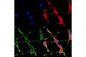 Immunocytochemistry/Immunofluorescence analysis using Mouse Anti-SHANK1 Monoclonal Antibody, Clone S22-21 (ABIN2483702). (SHANK1 Antikörper  (AA 469-691) (Atto 594))