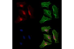 Phospho-Bcl6 (Ser333) Antibody staining A549 cells(heat shock treatment) by IF/ICC.