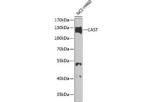 Western blot analysis of extracts of H460 cells, using CAST antibody (ABIN3015047, ABIN3015048, ABIN5663576 and ABIN6213614) at 1:1000 dilution. (Calpastatin Antikörper  (C-Term))