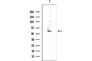 Western blot analysis of lysates from Mouse testis, using Cytochrome P450 27 Antibody at 1/1000 dilution.