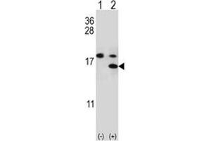 Western blot analysis of S100A11 antibody and 293 cell lysate either nontransfected (Lane 1) or transiently transfected (2) with the S100A11 gene. (S100A11 Antikörper  (AA 1-30))