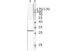 Western Blot testing of HIV-1 recombinant Nef protein. (HIV-1 Nef (AA 171-190) Antikörper)