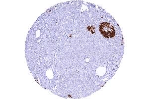Pancreas with strong cytoplasmic C peptide staining of most islet cells (Rekombinanter C-Peptide Antikörper)