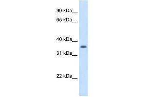 AKR1B10 antibody used at 1.