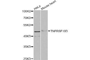 Western blot analysis of extracts of various cell lines, using TNFRSF10D antibody (ABIN5973614) at 1/1000 dilution. (DcR2 Antikörper)