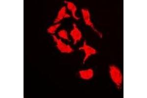 Immunofluorescent analysis of Cullin 4A staining in U2OS cells. (Cullin 4A Antikörper)