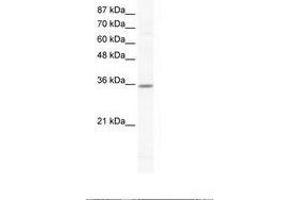Image no. 1 for anti-Cyclin G2 (CCNG2) (N-Term) antibody (ABIN202291) (Cyclin G2 Antikörper  (N-Term))